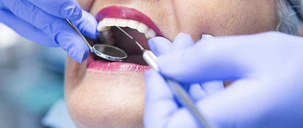 Best Broken Tooth Emergency  in Spring Valley Village, TX